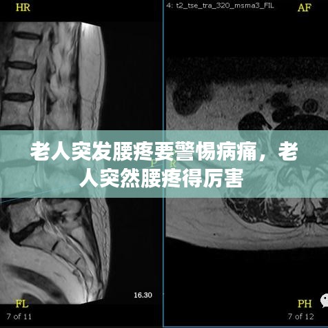 老人突发腰疼要警惕病痛，老人突然腰疼得厉害 