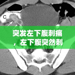 突发左下腹刺痛，左下腹突然刺痛的原因 