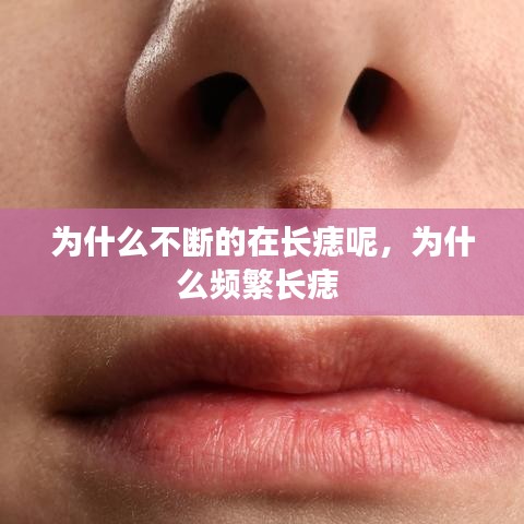 为什么不断的在长痣呢，为什么频繁长痣 