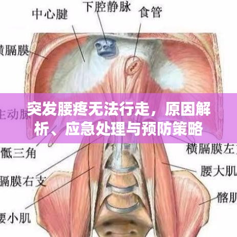 突发腰疼无法行走，原因解析、应急处理与预防策略