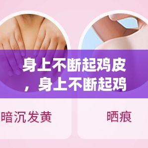 身上不断起鸡皮，身上不断起鸡皮疙瘩痒 