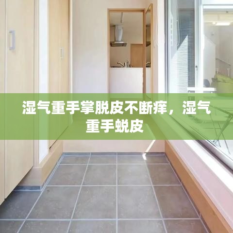 湿气重手掌脱皮不断痒，湿气重手蜕皮 