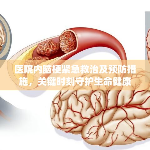 医院内脑梗紧急救治及预防措施，关键时刻守护生命健康