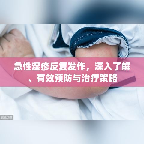 急性湿疹反复发作，深入了解、有效预防与治疗策略