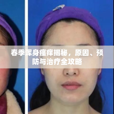 春季浑身瘙痒揭秘，原因、预防与治疗全攻略